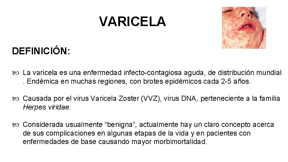 VARICELA DEFINICIÓN: La varicela es una enfermedad infecto-contagiosa aguda, de distribución mundial. Endémica en