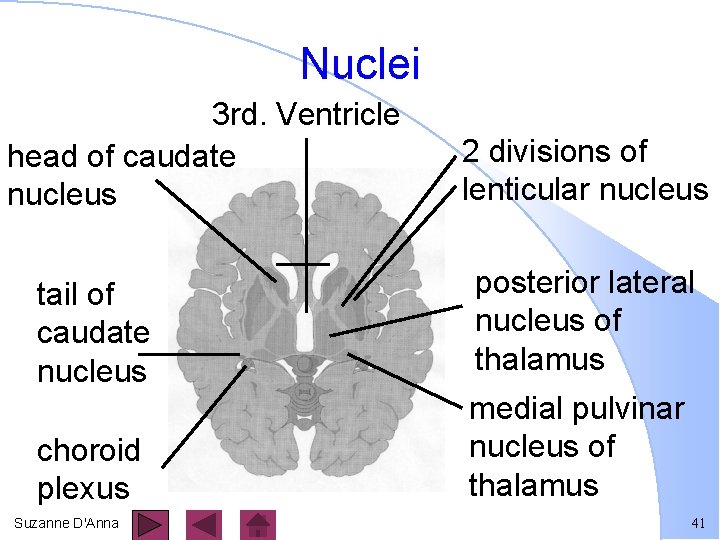 Nuclei 3 rd. Ventricle head of caudate nucleus 2 divisions of lenticular nucleus tail