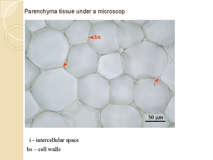 Parenchyma tissue under a microscop i - intercellular space bs – cell walls 