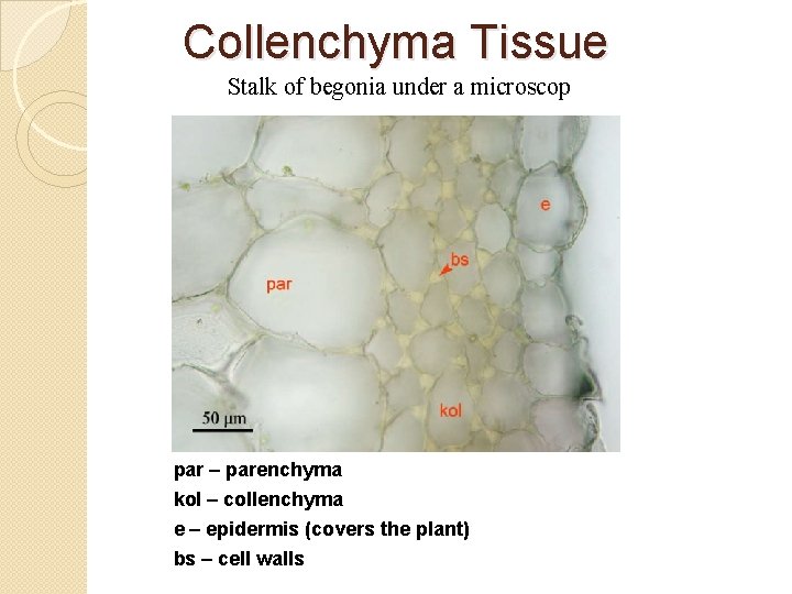 Collenchyma Tissue Stalk of begonia under a microscop par – parenchyma kol – collenchyma