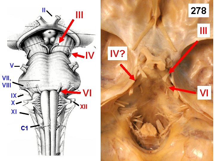 II 278 III IV IV? V VII, VIII VI IX X XI XII C