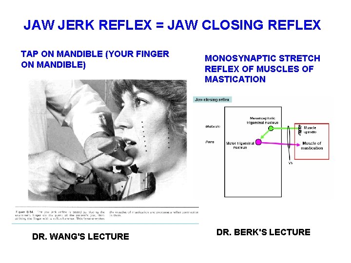 JAW JERK REFLEX = JAW CLOSING REFLEX TAP ON MANDIBLE (YOUR FINGER ON MANDIBLE)