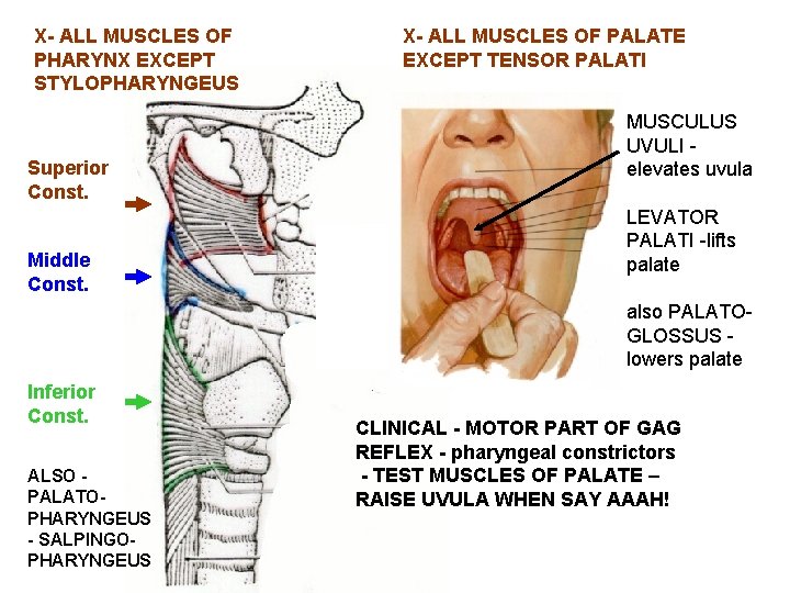 X- ALL MUSCLES OF PHARYNX EXCEPT STYLOPHARYNGEUS Superior Const. Middle Const. X- ALL MUSCLES