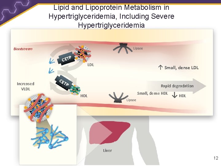 Lipid and Lipoprotein Metabolism in Hypertriglyceridemia, Including Severe Hypertriglyceridemia Lipase Bloodstream CETP Increased VLDL