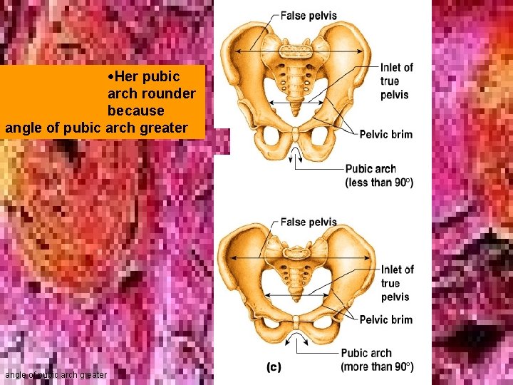  Her pubic arch rounder because angle of pubic arch greater 