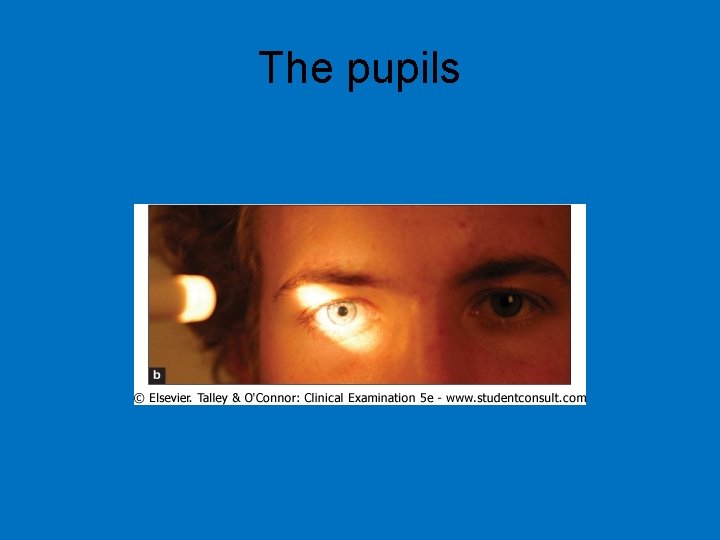 The pupils 