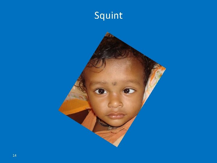 Squint 14 