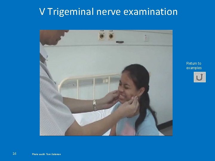 V Trigeminal nerve examination Return to examples 16 Photo credit: Tom Solomon 