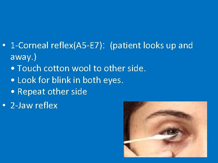  • 1 -Corneal reflex(A 5 -E 7): (patient looks up and away. )