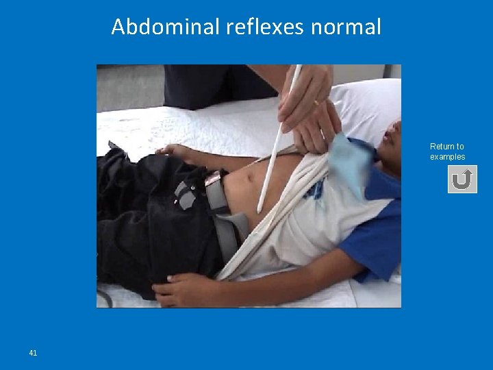 Abdominal reflexes normal Return to examples 41 