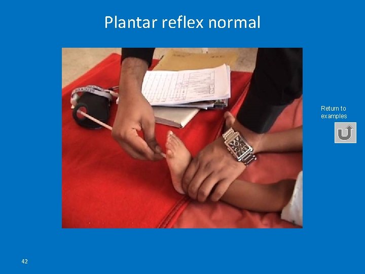 Plantar reflex normal Return to examples 42 