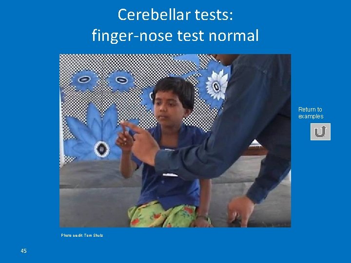 Cerebellar tests: finger-nose test normal Return to examples Photo credit: Tom Shulz 45 