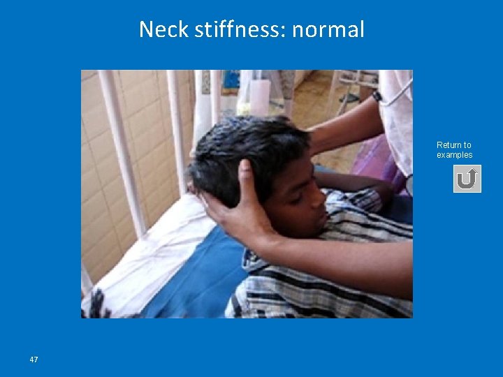 Neck stiffness: normal Return to examples 47 