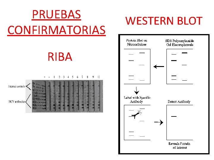 PRUEBAS CONFIRMATORIAS RIBA WESTERN BLOT 