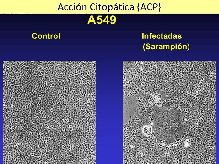 Acción Citopática (ACP) 