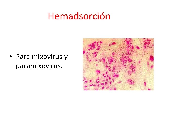 Hemadsorción • Para mixovirus y paramixovirus. 