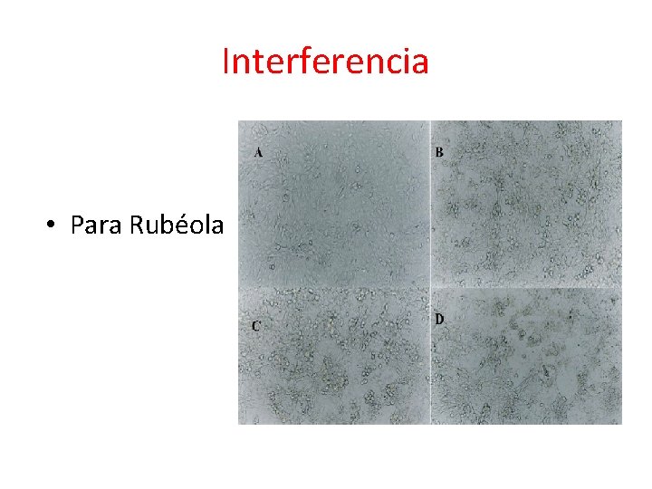 Interferencia • Para Rubéola 