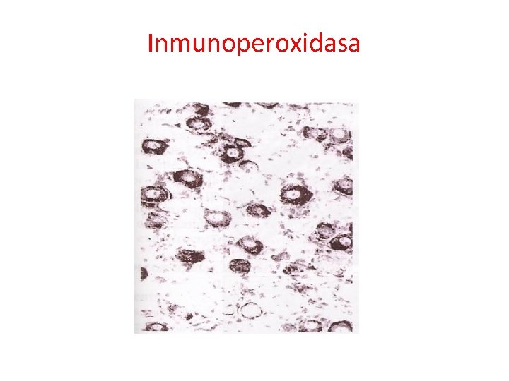 Inmunoperoxidasa 