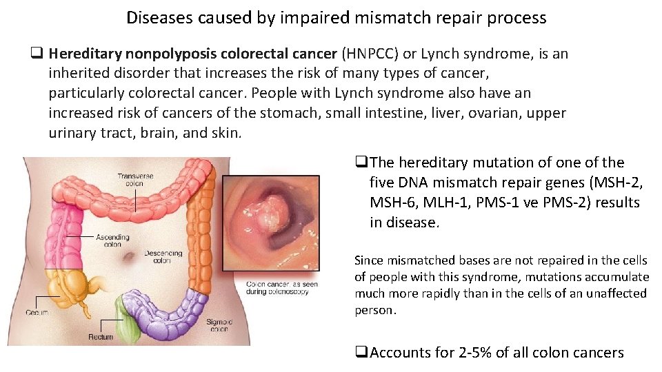 Diseases caused by impaired mismatch repair process q Hereditary nonpolyposis colorectal cancer (HNPCC) or