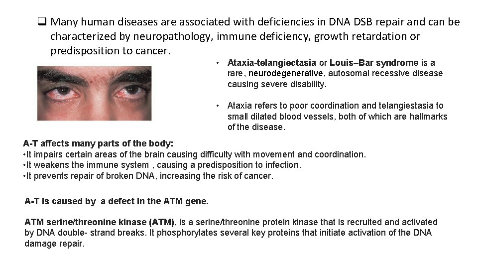 q Many human diseases are associated with deficiencies in DNA DSB repair and can