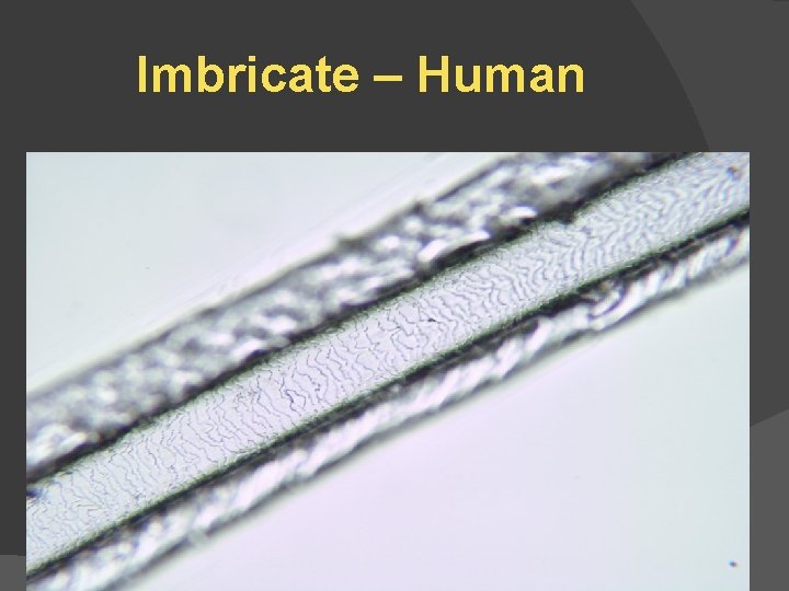 Imbricate – Human 