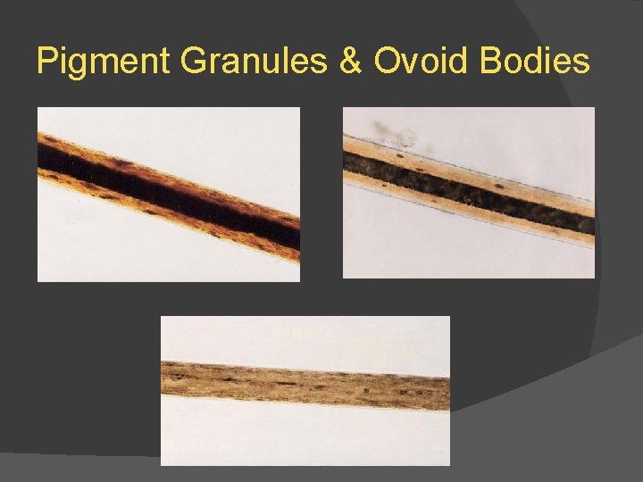 Pigment Granules & Ovoid Bodies 
