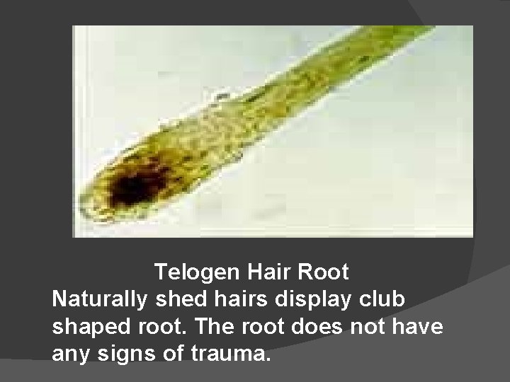 Telogen Hair Root Naturally shed hairs display club shaped root. The root does not