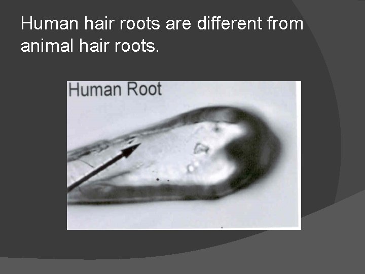 Human hair roots are different from animal hair roots. 