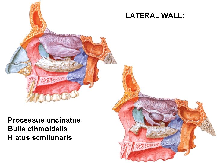 LATERAL WALL: Processus uncinatus Bulla ethmoidalis Hiatus semilunaris 