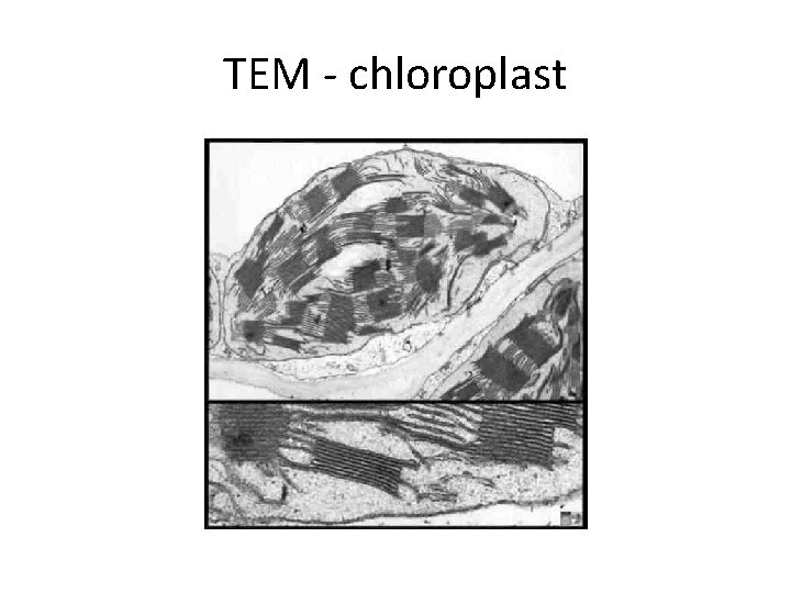 TEM - chloroplast 