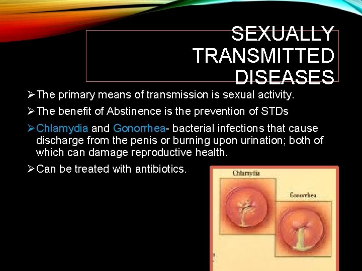 SEXUALLY TRANSMITTED DISEASES ØThe primary means of transmission is sexual activity. ØThe benefit of