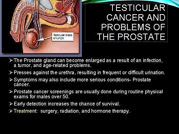 TESTICULAR CANCER AND PROBLEMS OF THE PROSTATE Ø The Prostate gland can become enlarged