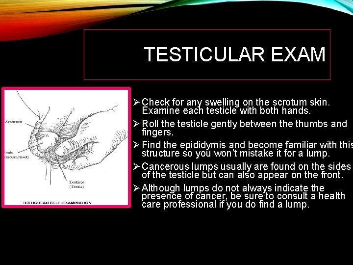 TESTICULAR EXAM Ø Check for any swelling on the scrotum skin. Examine each testicle