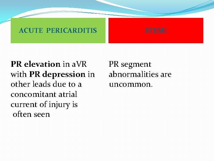 ACUTE PERICARDITIS PR elevation in a. VR with PR depression in other leads due