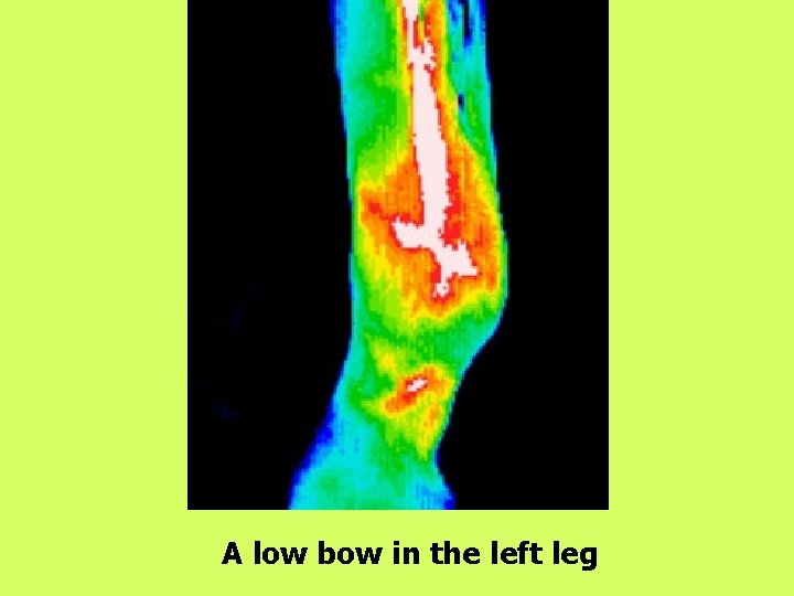 A low bow in the left leg 