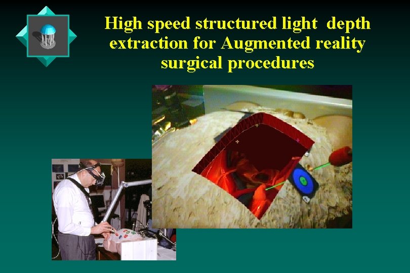 High speed structured light depth extraction for Augmented reality surgical procedures High speed structured light depth extraction for Augmented reality surgical procedures