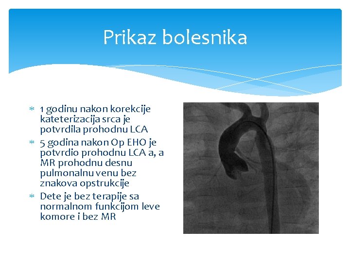 Prikaz bolesnika 1 godinu nakon korekcije kateterizacija srca je potvrdila prohodnu LCA 5 godina