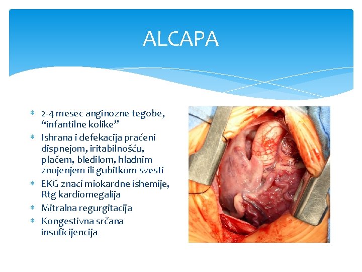 ALCAPA 2 -4 mesec anginozne tegobe, “infantilne kolike” Ishrana i defekacija praćeni dispnejom, iritabilnošću,