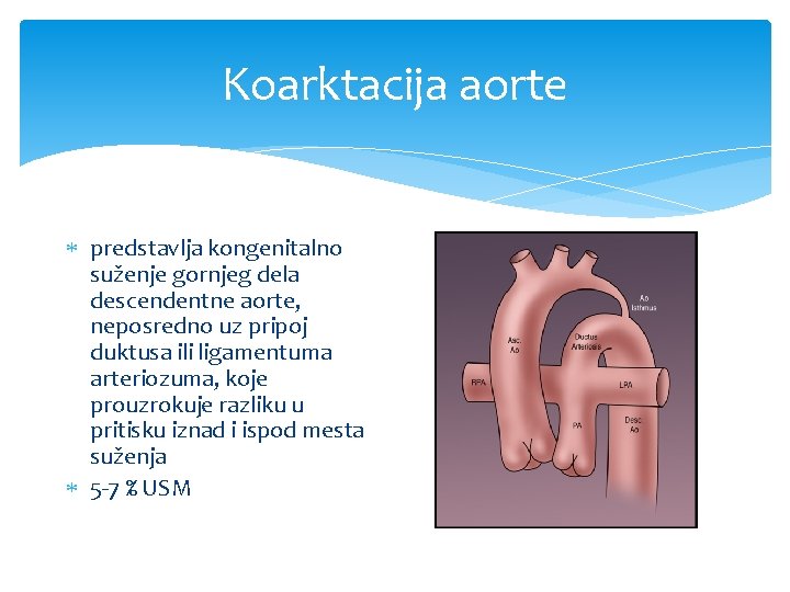 Koarktacija aorte predstavlja kongenitalno suženje gornjeg dela descendentne aorte, neposredno uz pripoj duktusa ili