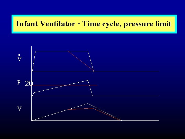 Infant Ventilator - Time cycle, pressure limit V P V 20 