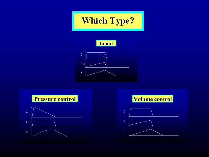 Which Type? 