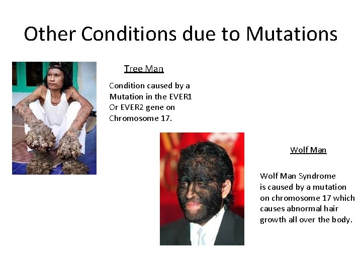 Other Conditions due to Mutations Tree Man Condition caused by a Mutation in the