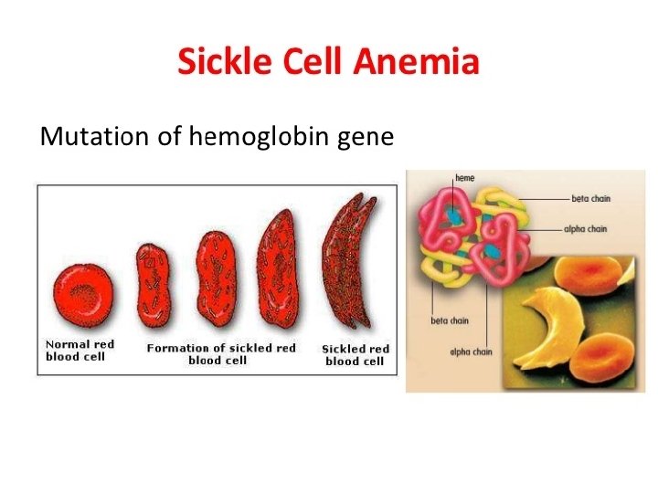 Sickle Cell causes a great deal of pain fatigue and an enlarged spleen 