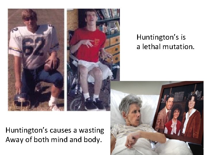 Huntington’s is a lethal mutation. Huntington’s causes a wasting Away of both mind and