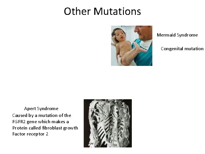 Other Mutations Mermaid Syndrome Congenital mutation Apert Syndrome Caused by a mutation of the