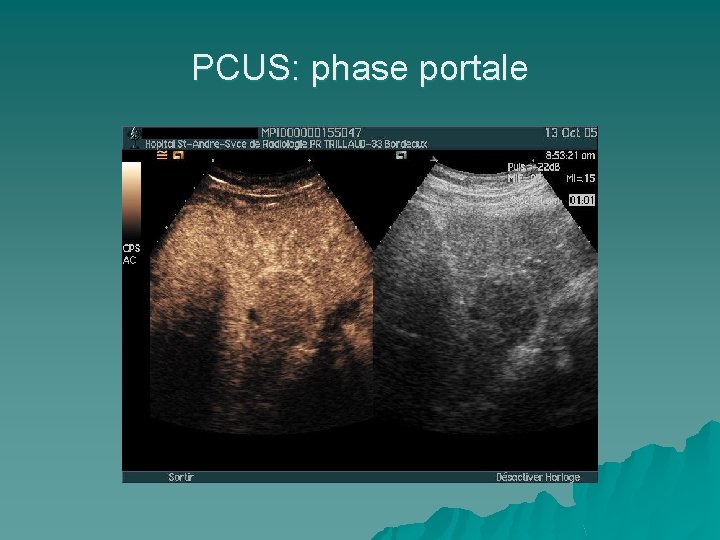 PCUS: phase portale 