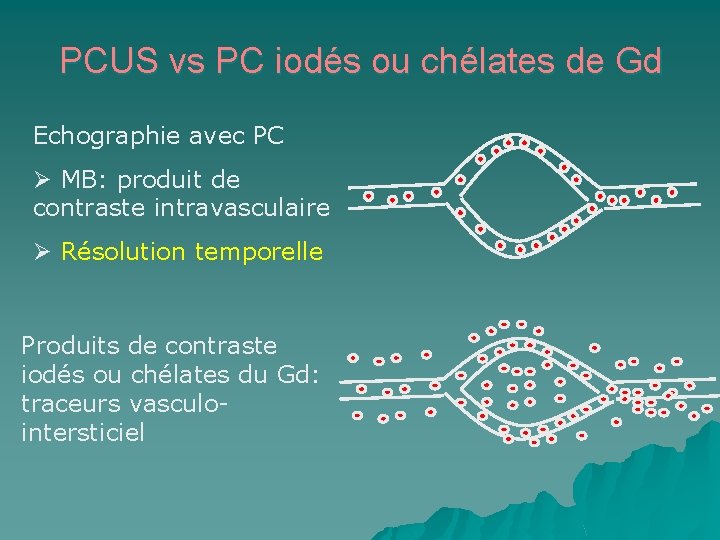 PCUS vs PC iodés ou chélates de Gd Echographie avec PC Ø MB: produit