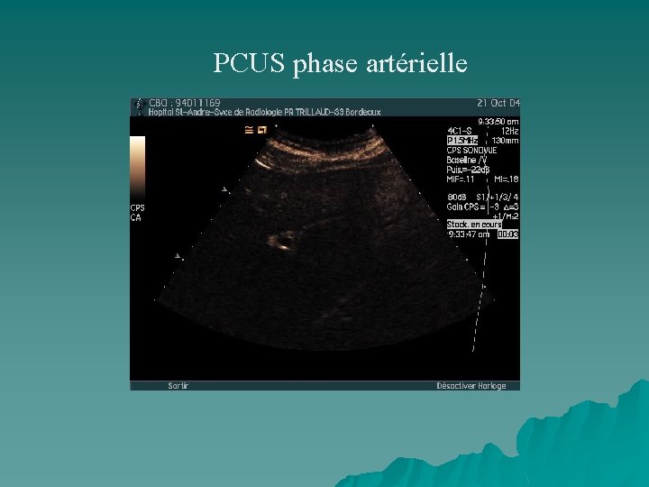 PCUS phase artérielle 