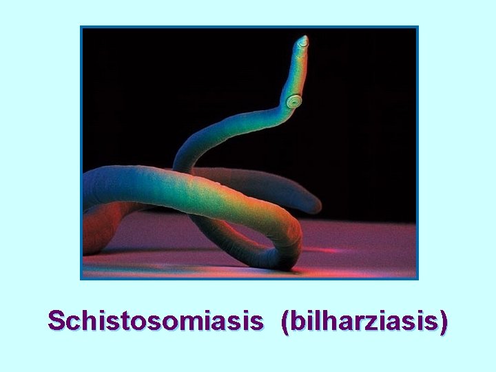 Schistosomiasis (bilharziasis) 