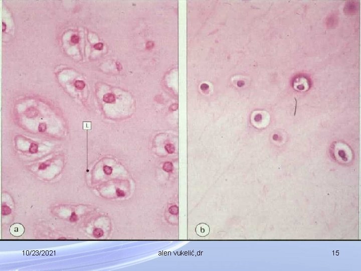 10/23/2021 alen vukelić, dr 15 